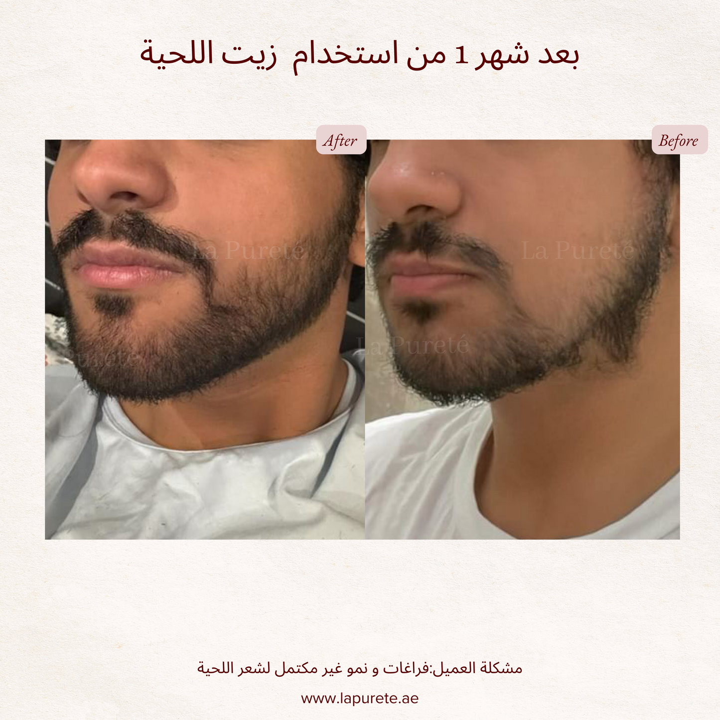 Beard Growth Oil